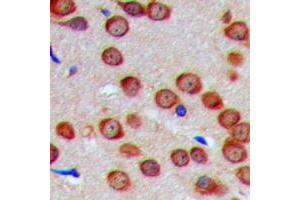 Immunohistochemical analysis of GTPBP5 staining in human brain formalin fixed paraffin embedded tissue section.