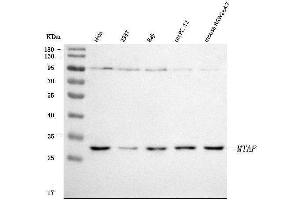 Western blot analysis of MTAP using anti-MTAP antibody (ABIN7601258).