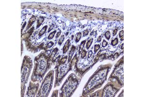 IHC analysis of splicing factor 1 using anti-splicing factor 1 antibody .