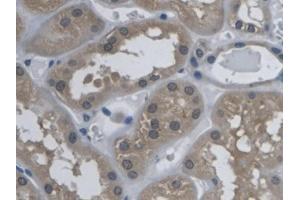 DAB staining on IHC-P; Samples: Human Kidney Tissue