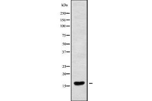 Western blot analysis of RPC9 using HuvEc whole cell lysates (CRCP anticorps  (N-Term))