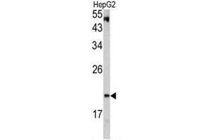 Western blot analysis of VHL antibody (C-term) in HepG2 cell line lysates (35ug/lane). (VHL anticorps  (C-Term))