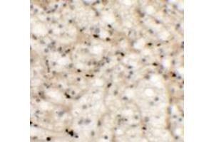 Immunohistochemistry of NKX2-6 in human spleen tissue with NKX2-6 antibody at 5 ug/mL.