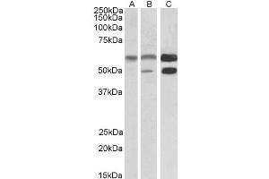 Western Blotting (WB) image for anti-Calcium/calmodulin-Dependent Protein Kinase II alpha (CAMK2A) antibody (ABIN5895999) (CAMK2A anticorps)