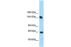 WB Suggested Anti-RRP12 Antibody Titration: 1. (RRP12 anticorps  (C-Term))