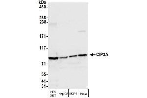 Western Blotting (WB) image for anti-KIAA1524 (KIAA1524) (AA 853-903) antibody (ABIN7453880) (KIAA1524 anticorps  (AA 853-903))