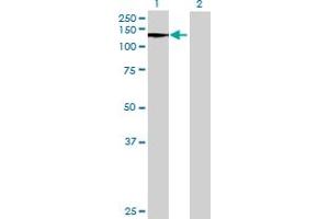 Western Blot analysis of DNMT3A expression in transfected 293T cell line by DNMT3A MaxPab polyclonal antibody. (DNMT3A anticorps  (AA 1-912))