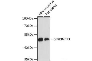 Western blot analysis of extracts of various cell lines using SERPINB13 Polyclonal Antibody at dilution of 1:3000.