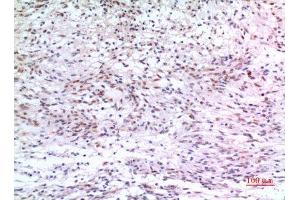 Immunohistochemistry (IHC) analysis of paraffin-embedded Human Brain, antibody was diluted at 1:100.