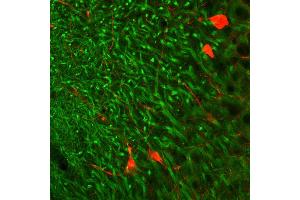 Indirect immunohystochemistry of a rat hippocampus section with anti-MAP 2 (dilution 1 : 500; green) and parvalbumin guinea pig antiserum (cat. (MAP2 anticorps  (AA 2-309))