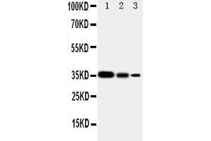 Lane 3: Recombinant Human SHC1 Proteins 2.