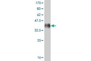Western Blot detection against Immunogen (36. (MED17 anticorps  (AA 551-651))