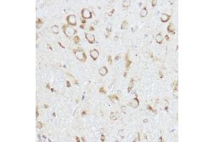 Immunohistochemistry of paraffin-embedded mouse spinal cord using NEURL1B Rabbit pAb (ABIN7268857) at dilution of 1:100 (40x lens).