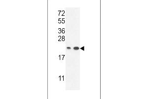 ABHEB Antibody (C-term) (ABIN653654 and ABIN2842995) western blot analysis in ,T47D cell line lysates (35 μg/lane). (ABHD14B anticorps  (C-Term))