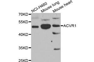 Western blot analysis of extracts of various cell lines, using ACVR1 antibody (ABIN5975601) at 1/1000 dilution. (ACVR1 anticorps)