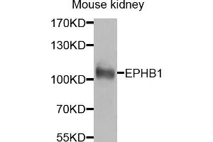 Western blot analysis of extracts of mouse kidney, using EPHB1 antibody (ABIN5974587) at 1/1000 dilution. (EPH Receptor B1 anticorps)