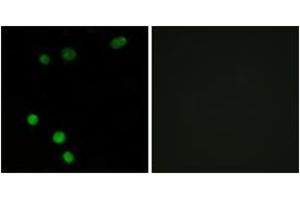 Immunofluorescence analysis of MCF7 cells, using TP53INP2 Antibody.