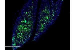 Immunohistochemistry analysis using Mouse Anti-Thyroid Hormone Receptor Monoclonal Antibody, Clone H43 (ABIN6952045).
