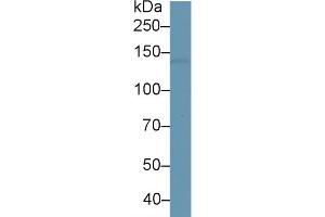 Rabbit Capture antibody from the kit in WB with Positive Control: Human brain tissue. (L1CAM Kit ELISA)