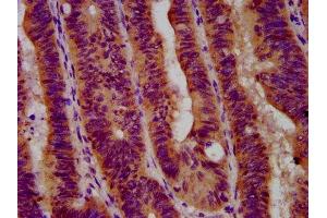 anti-Glucosidase, Beta, Acid (GBA) (AA 215-343) antibody