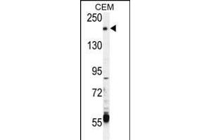 CHAK2 Antibody  (ABIN392616 and ABIN2842133) western blot analysis in CEM cell line lysates (35 μg/lane). (TRPM6 anticorps  (AA 317-348))