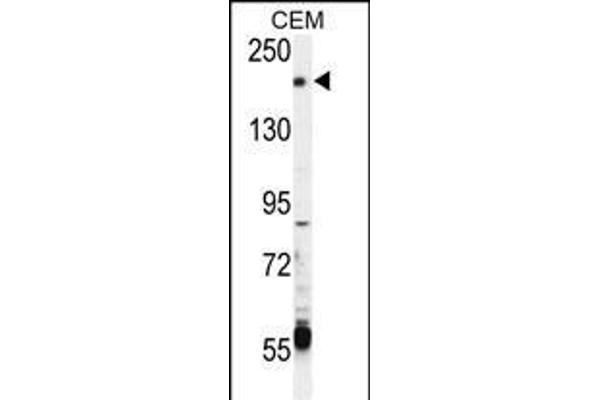 TRPM6 anticorps  (AA 317-348)