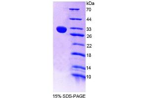SDS-PAGE analysis of Mouse CHIT1 Protein. (Chitotriosidase 1 Protéine)