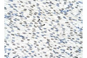 RBM22 antibody was used for immunohistochemistry at a concentration of 4-8 ug/ml to stain Myocardial cells (arrows) in Human Heart.