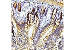 IHC analysis of RET using anti-RET antibody (ABIN6719502). (Ret Proto-Oncogene anticorps  (AA 29-304))