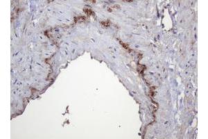 Image no. 1 for anti-Parvin, beta (PARVB) antibody (ABIN1496912)