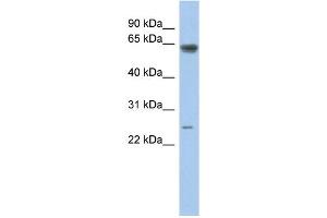 WB Suggested Anti-TAF5L Antibody Titration:  0. (TAF5L anticorps  (Middle Region))