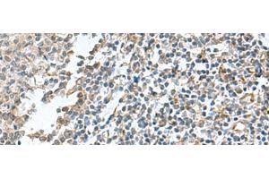 Immunohistochemistry of paraffin-embedded Human tonsil tissue using PAPSS2 Polyclonal Antibody at dilution of 1:95(x200)