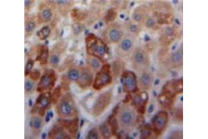 Used in DAB staining on fromalin fixed paraffin-embedded Liver tissue (COL18 anticorps  (AA 1591-1774))