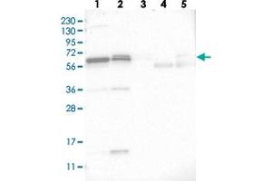 Western blot analysis of Lane 1: RT-4, Lane 2: U-251 MG, Lane 3: Human Plasma, Lane 4: Liver, Lane 5: Tonsil with C17orf70 polyclonal antibody  at 1:250-1:500 dilution. (C17orf70 anticorps)
