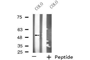 Western blot analysis of extracts from COLO cells, using KCNG2 antibody.