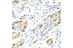 Immunohistochemistry of paraffin-embedded human stomach using BLVRB antibody at dilution of 1:100 (40x lens). (BLVRB anticorps)