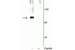 Western blot of rat cortical lysate showing specific labeling of the ~78 kDa synapsin protein phosphorylated at Ser62,67 in the first lane (-). (SYN1 anticorps  (pSer62, pSer67))