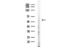 Western blot analysis of lysates from Rat brain, using CCDC102A Antibody at 1/1000 dilution.