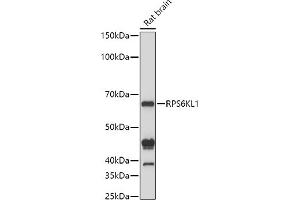 Western blot analysis of extracts of Rat brain cells, using RPS6KL1 antibody (ABIN6130681, ABIN6147242, ABIN6147243 and ABIN6223376) at 1:1000 dilution. (RPS6KL1 anticorps  (AA 1-130))