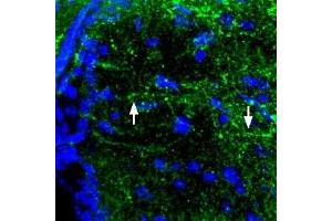 Expression of MC4R in mouse brainImmunohistochemical staining of perfusion-fixed frozen mouse brain sections using Anti-MC4 Receptor (extracellular) Antibody (ABIN7043324, ABIN7044596 and ABIN7044597), (1:100). (Melanocortin 4 Receptor (MC4R) Peptide)