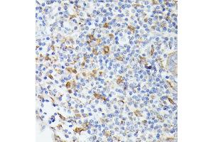 Immunohistochemistry of paraffin-embedded human appendix using TI antibody (ABIN6133213, ABIN6149144, ABIN6149145 and ABIN6221696) at dilution of 1:100 (40x lens). (TIAL1 anticorps  (AA 266-375))