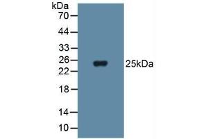 Detection of SOD3 in Human Blood Cells using Polyclonal Antibody to Superoxide Dismutase 3, Extracellular (SOD3)