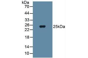 Detection of SOD3 in Human Blood Cells using Polyclonal Antibody to Superoxide Dismutase 3, Extracellular (SOD3) (SOD3 anticorps  (AA 19-240))