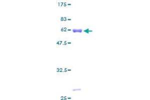 SDS-PAGE (SDS) image for Pyruvate Dehydrogenase beta (PDHB) (AA 1-359) protein (GST tag) (ABIN1314523)