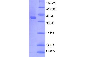 30S Ribosomal Protein S10 (AA 1-103), (full length) protein (GST tag)