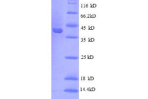 30S Ribosomal Protein S10 (AA 1-103), (full length) protein (GST tag) (30S Ribosomal Protein S10 (RpsJ) (AA 1-103), (full length) protein (GST tag))