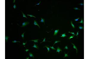 Immunofluorescence staining of U251 cells with ABIN7148054-IF at 1:100, counter-stained with DAPI.