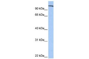 FES antibody used at 1 ug/ml to detect target protein. (FES anticorps  (N-Term))