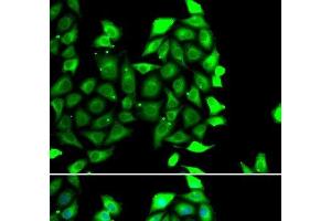 Immunofluorescence analysis of MCF-7 cells using IKZF3 Polyclonal Antibody (IKZF3 anticorps)