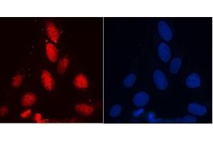 IF analysis of RENT1/hUPF1 using anti-RENT1/hUPF1 antibody (ABIN7602979).